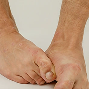 General Toe Pain Banner