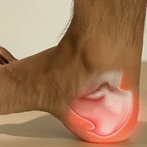 General Heel Pain Banner