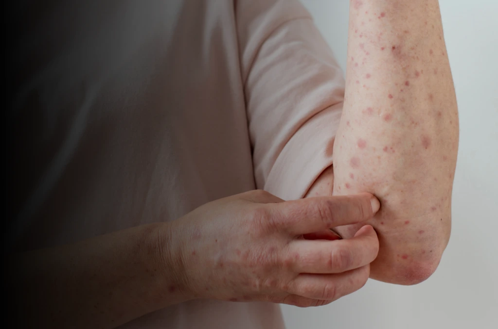 Vascular Malformations Banner