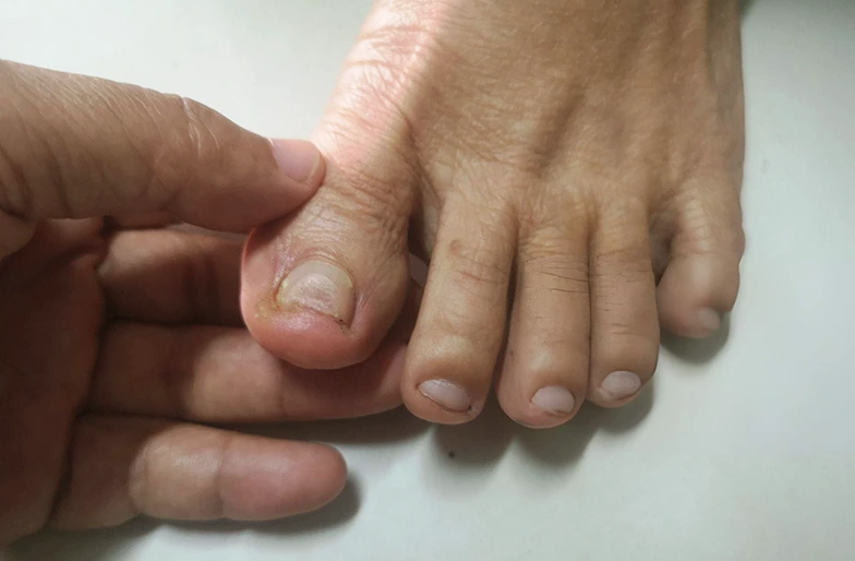 Toe Pain Banner
