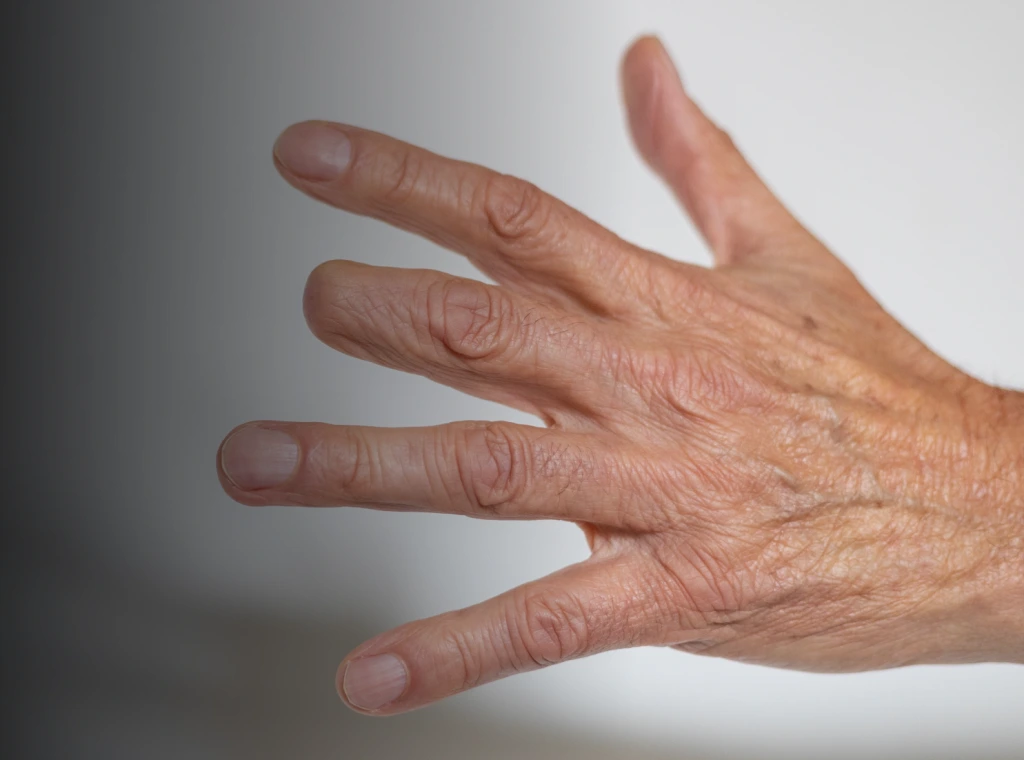 Finger Amputations Banner