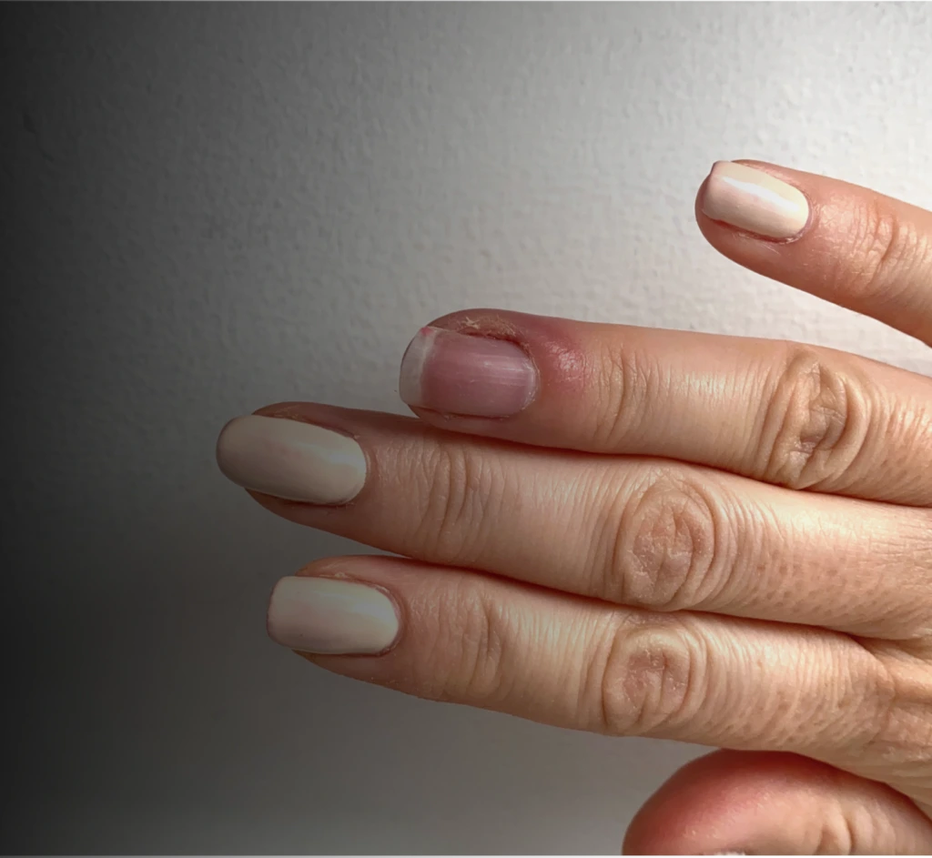 Nail Injury Deformity Banner