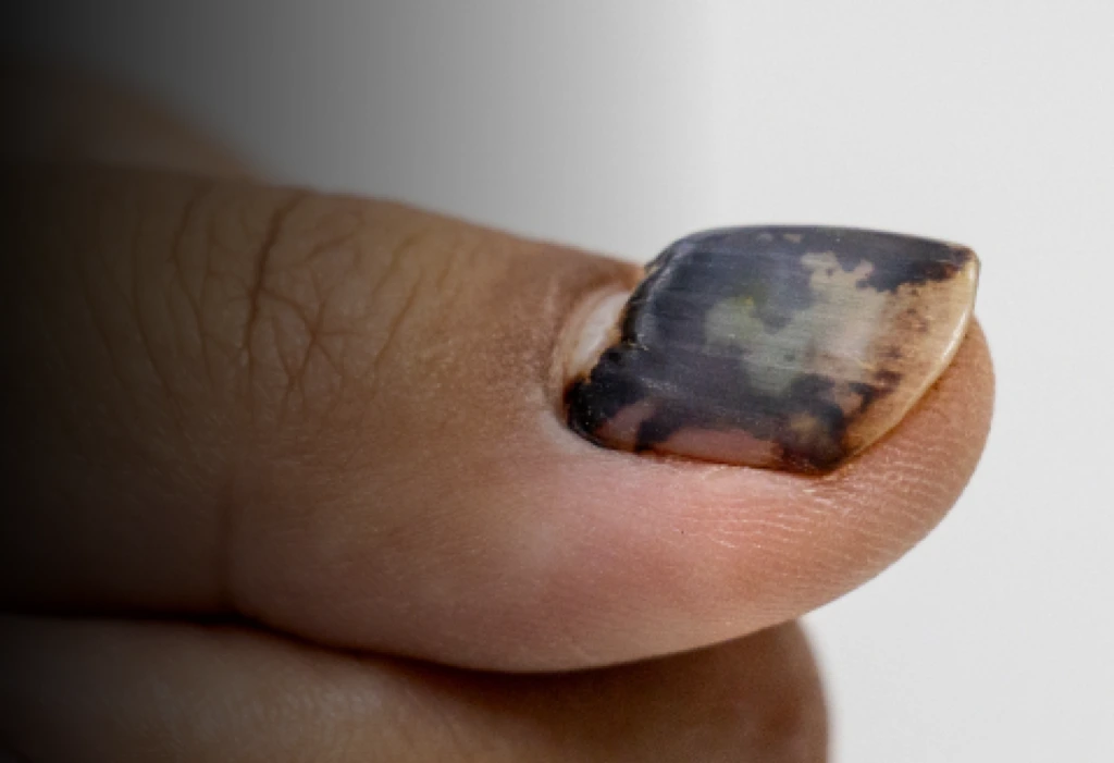Nail Repair Banner
