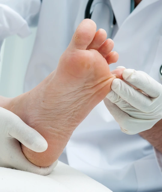Consultation for Toenail Fungus Treatment Banner