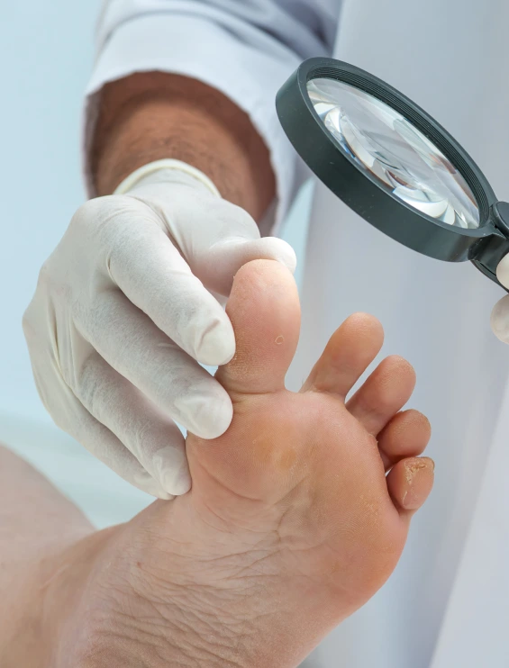 Treatments for Athlete’s Foot Banner