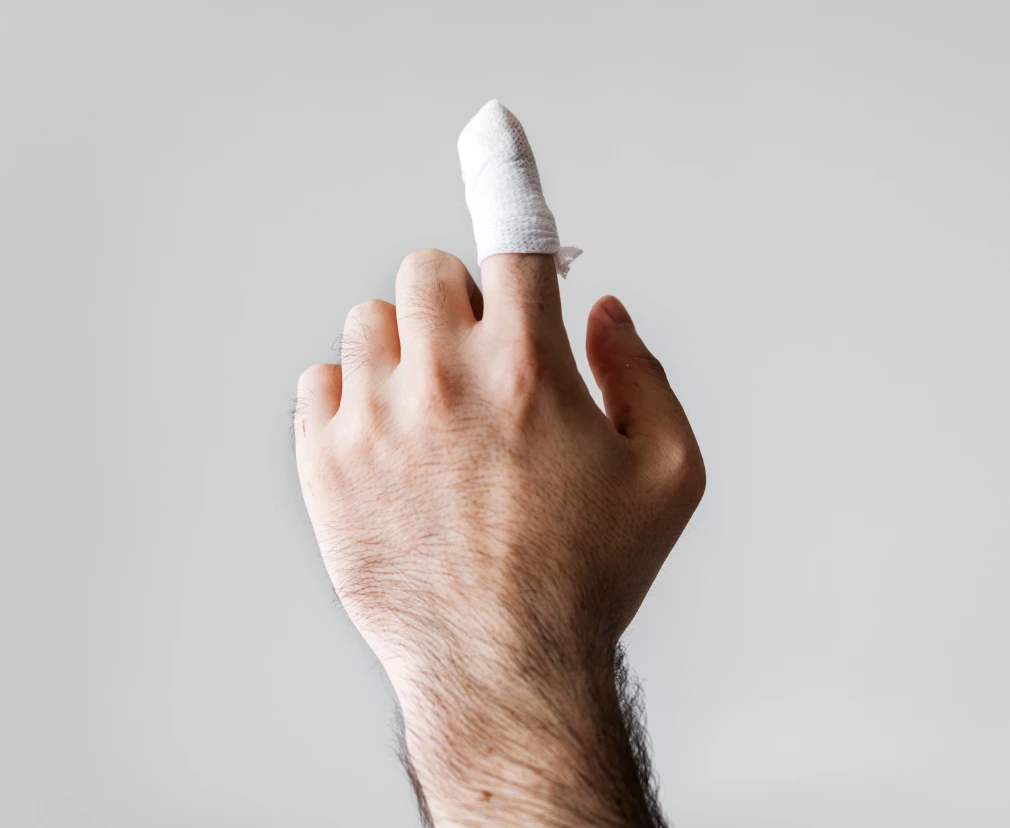 Miami Florida Hand Conditions: Phalangeal Fractures Banner