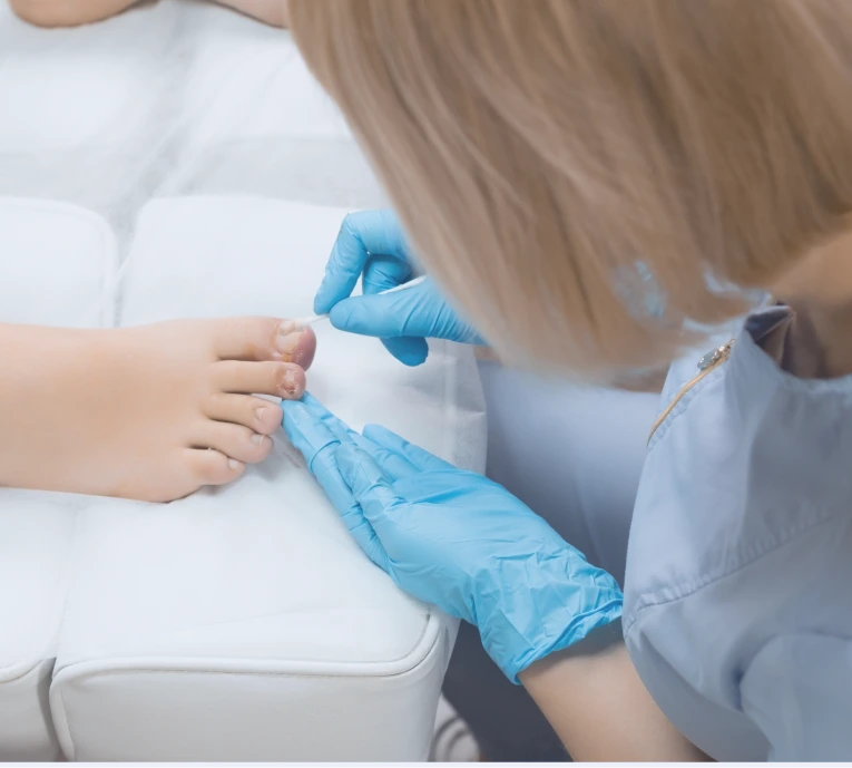 Benefits of Ingrown Nail Treatment Banner