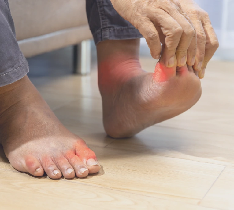 Candidates for Neuroma Treatment Banner