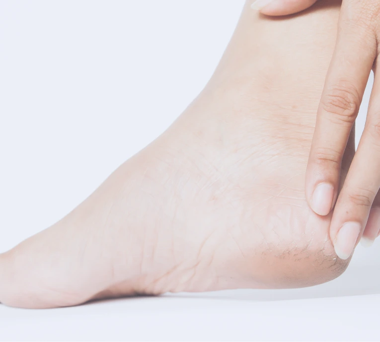 What Is Plantar Fasciitis? Banner