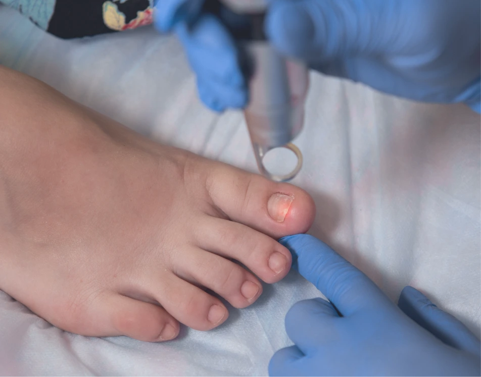 Benefits of Treating Fungal Nails Miami FL Banner
