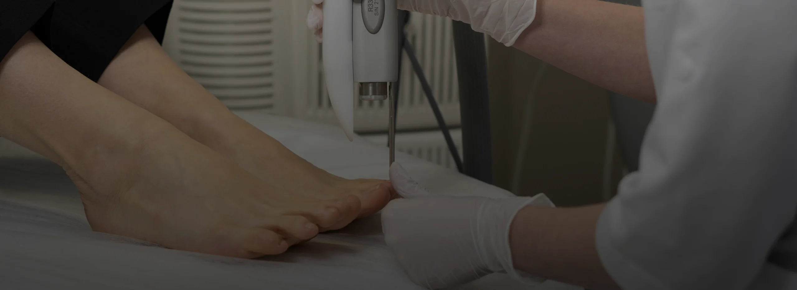 Laser Nail Fungus Treatment in Miami, FL Bg