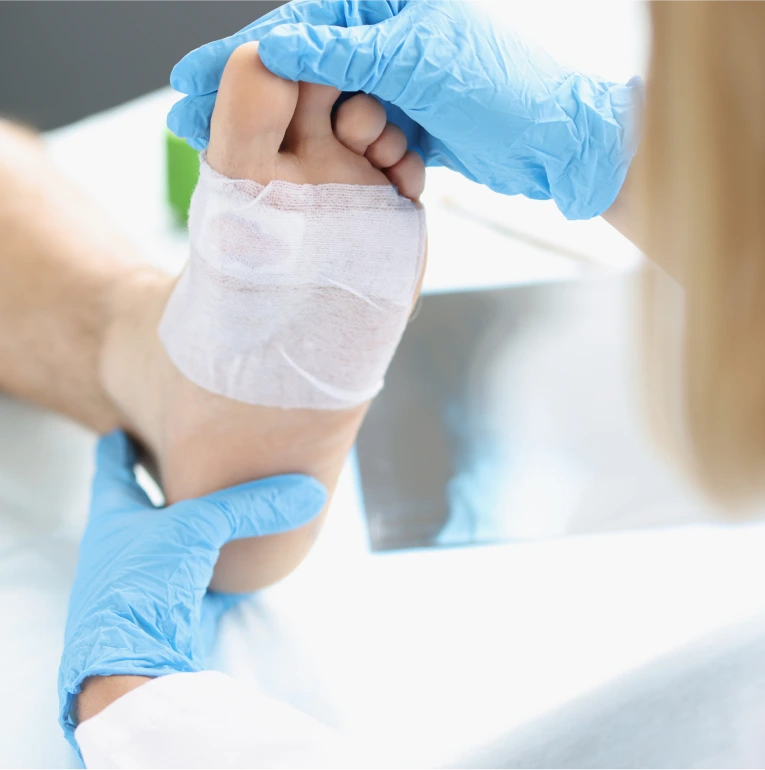 Recovery After Sesamoiditis Treatment in Miami, Florida Banner