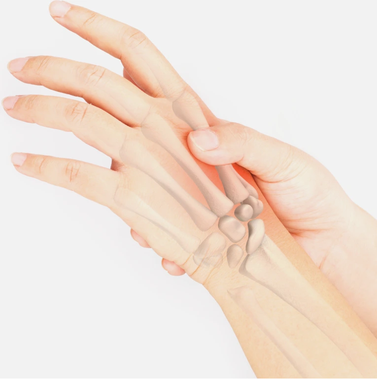 Candidates for Phalangeal Fracture Treatment Miami FL Banner