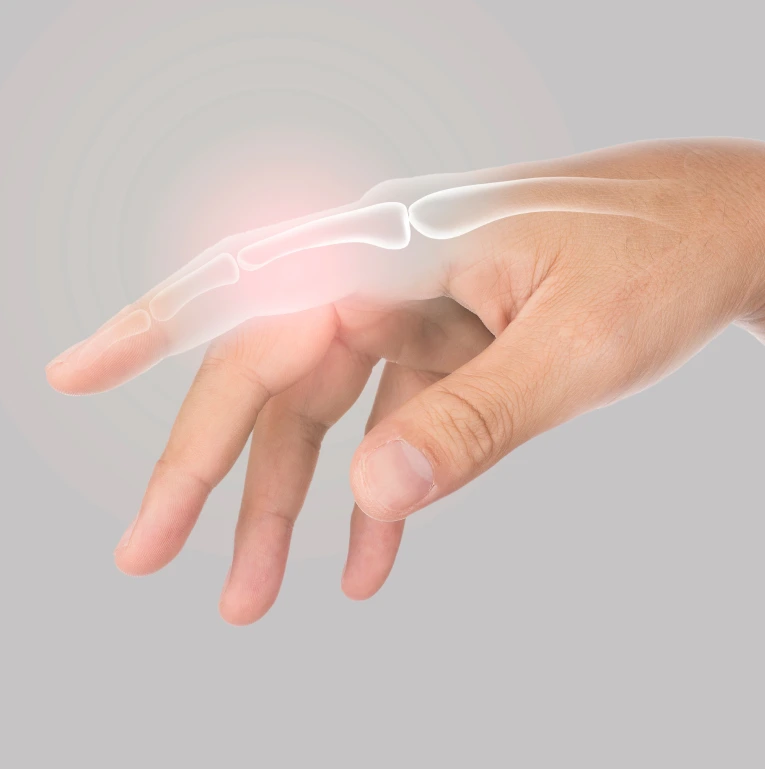 What Are Phalangeal Fractures Treatment Miami, FL Banner