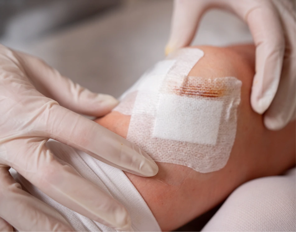Wound Debridement Treatment in Miami, FL Banner
